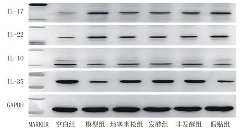 空白組和支氣管哮喘各組大鼠肺組織中IL－17、IL－22、IL－10、IL－35蛋白表達電泳圖